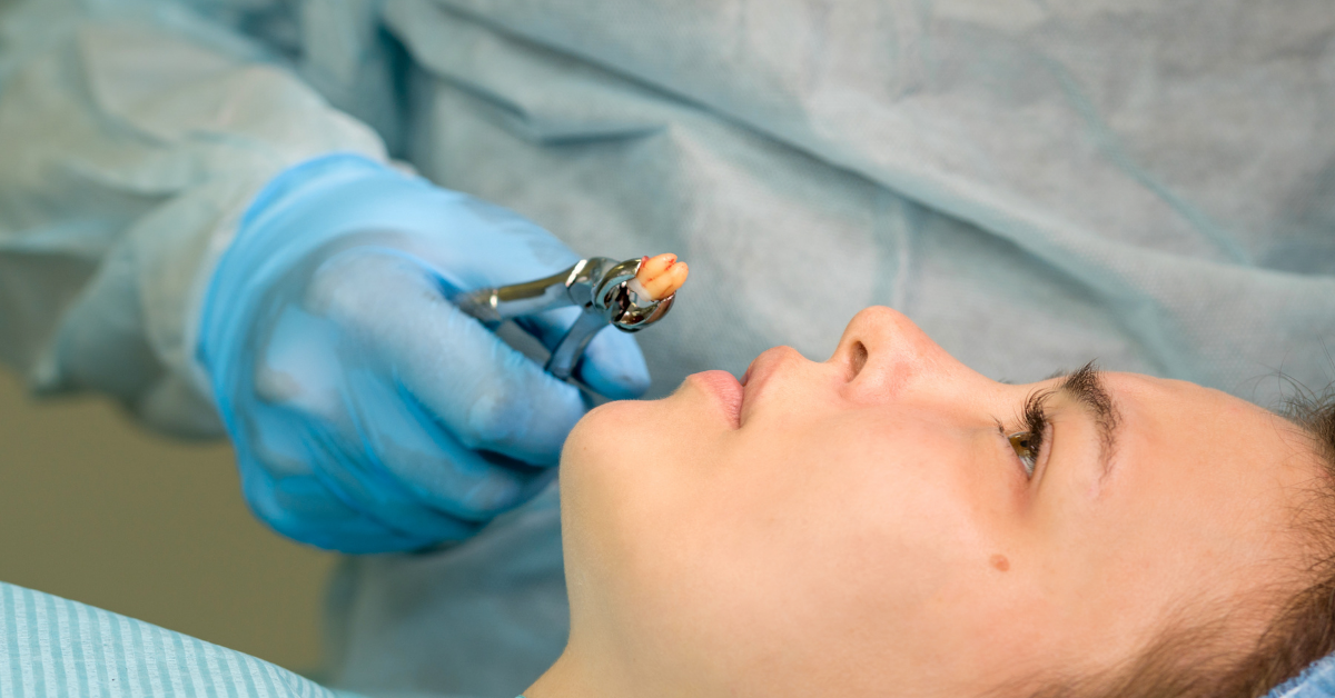 Impacted Tooth Extractions (Wisdom Tooth Extractions) Gomulu Dis Cekimleri Yirmi Yas Dis Cekimleri Dt Ayse Erken 1