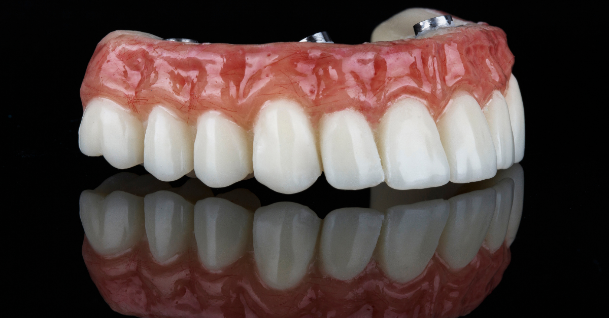 Implant Ustu Sabit Protezler Dt Ayse Erken