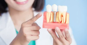 İmplant Fiyatları - Dt Ayşe Erken