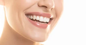 Estetik Dis Hekimliginde En Dogal Gulus Dt Ayse Erken