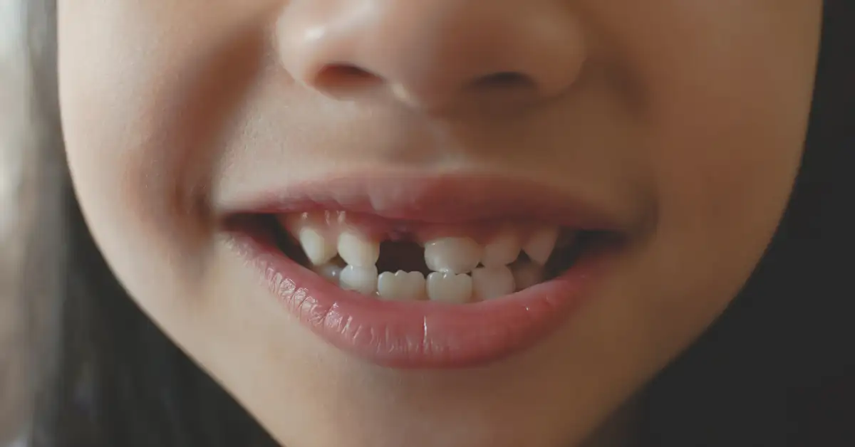 Sut Disi Erken Duserse Ne Yapilmali Dt Ayse ERKEN